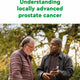 Understanding locally advanced prostate cancer