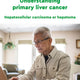 Understanding primary liver cancer: hepatocellular carcinoma or hepatoma