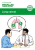 Lung cancer