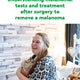 Understanding melanoma: Tests and treatments after surgery to remove a melanoma